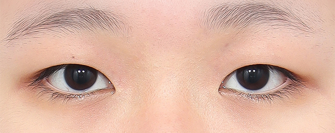Before